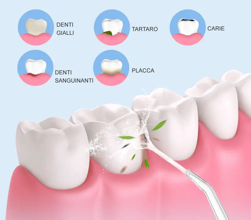 idropulsore orale per denti Professionale