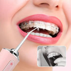 idropulsore orale per denti Professionale