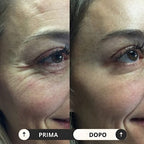 Massaggiatore Viso e Collo anti rughe e pulizia