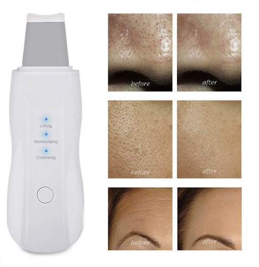 Scrubber peeling Professionale